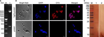 Nano vaccines for T. gondii Ribosomal P2 Protein With Nanomaterials as a Promising DNA Vaccine Against Toxoplasmosis